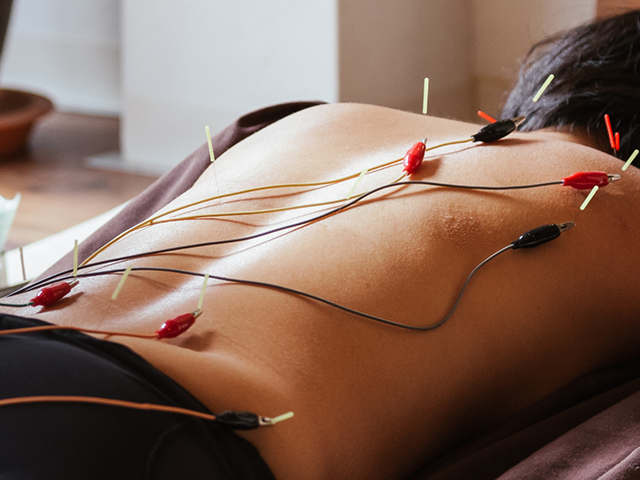 マイクロカレント