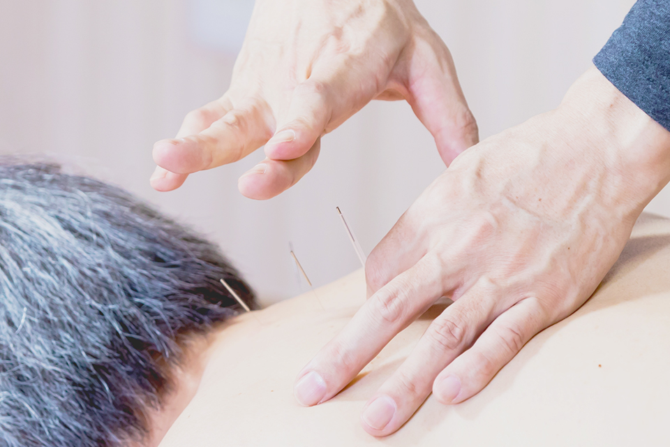 鍼灸施術画像